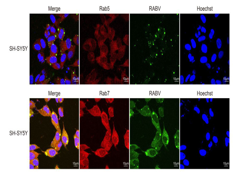 狂犬病病毒与早晚期内体蛋白(rab5和rab7)在神经元和sh-sy5y细胞共